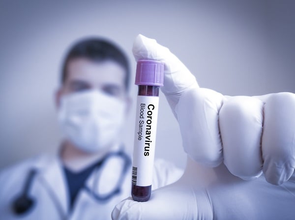 COVID-19 Coronavirus